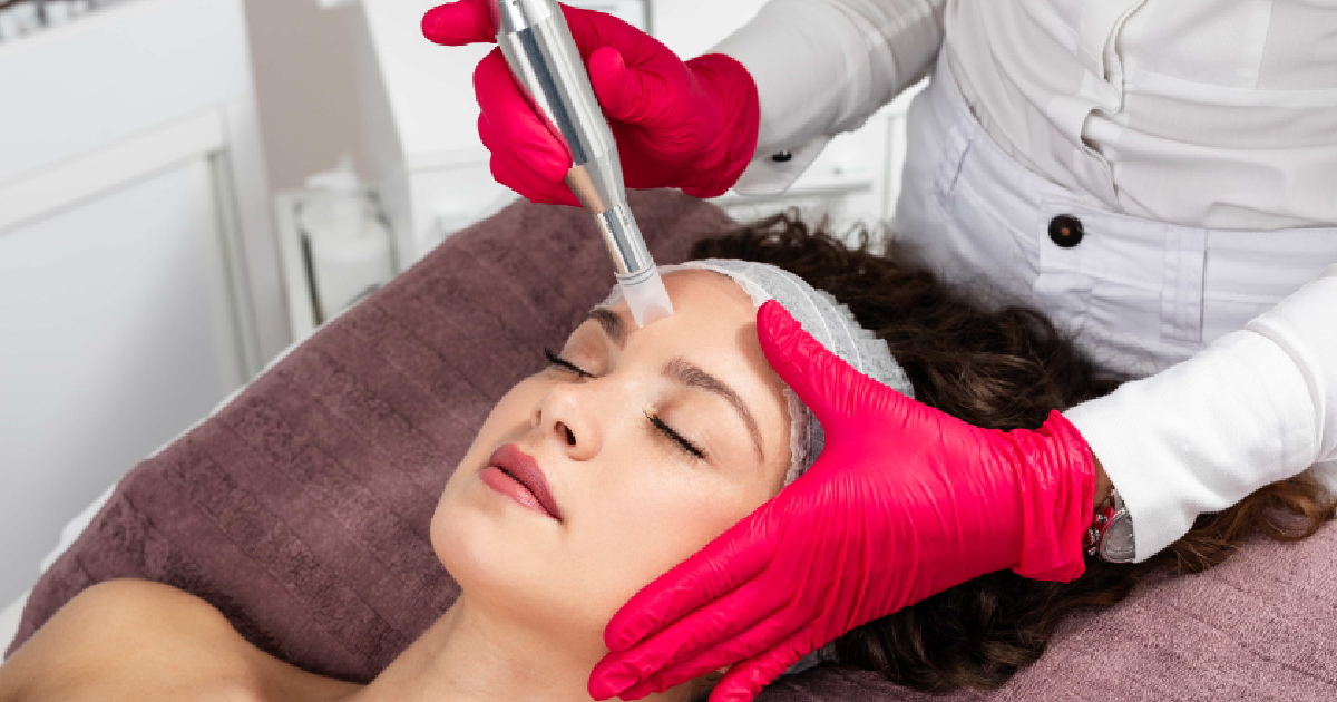 Woman undergoing Scarlet microneedling treatment in spa in Simi Valley, CA